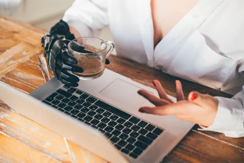 woman with prosthetic hand working on laptop 2023 11 27 04 51 58 utc